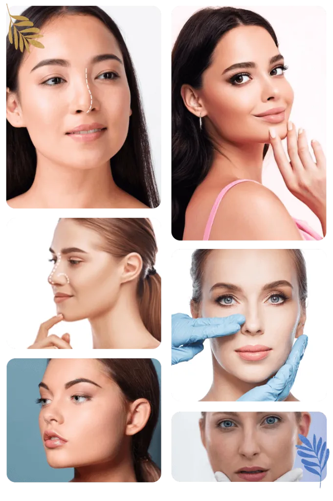 Nasal Polyp Surgery Turkey revision-rhinoplasty-types-