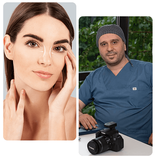 Non Surgical Rhinoplasty in Turkey non-surgical-rhinoplasty-in-turkey