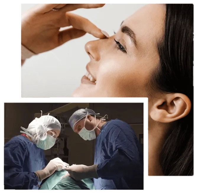 Non Surgical Rhinoplasty in Turkey what-is-non-surgical-rhinoplasty