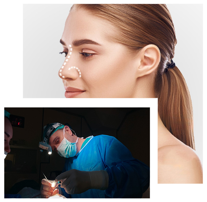 Revision Rhinoplasty in Turkey what is revision rhinoplasty