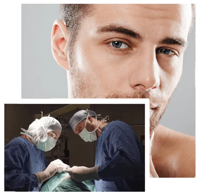 how-is-male-rhinoplasty-performed