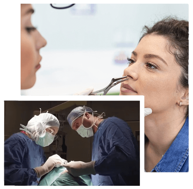 Nasal Polyp Surgery Turkey how-is-nasal-polyp-surgery-performed