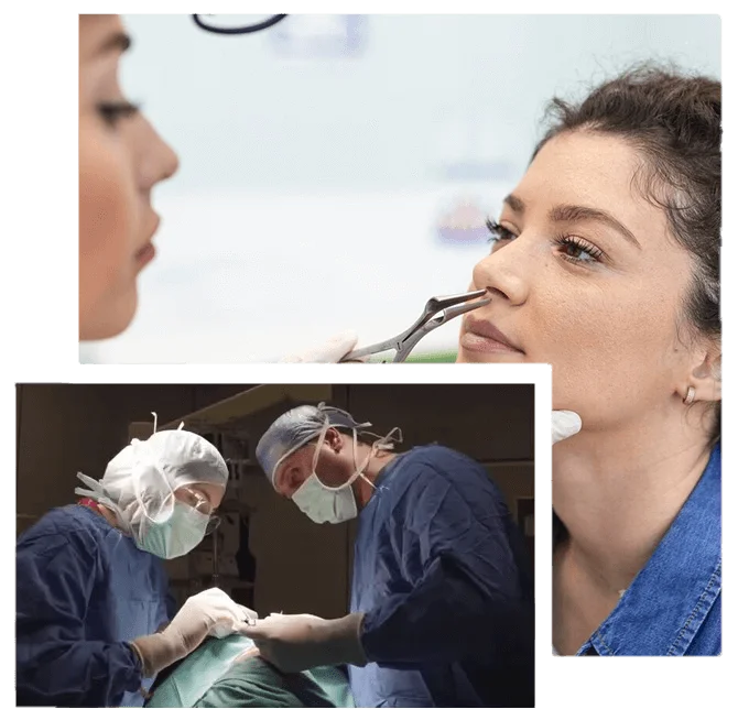 how-is-nasal-polyp-surgery-performed