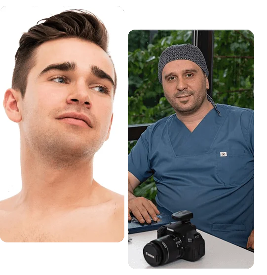 male-rhinoplasty-in-turkey