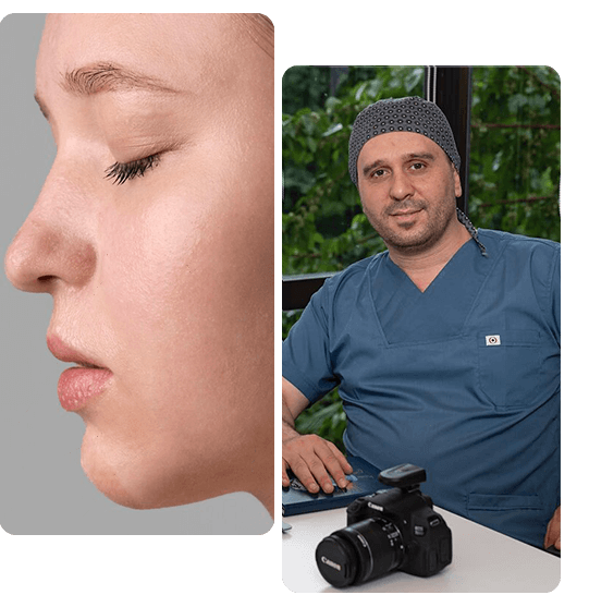 Nasal Polyp Surgery Turkey nasal-polyp-surgery-turkey
