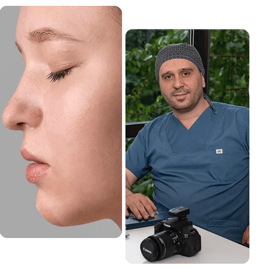 nasal-polyp-surgery-turkey