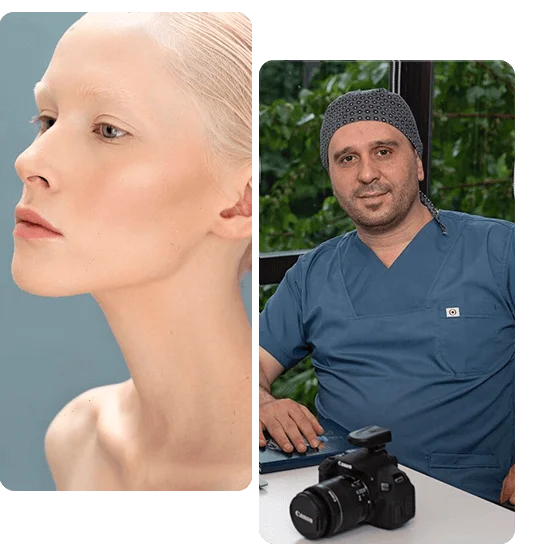 nasal-valve-collapse-surgery-turkey
