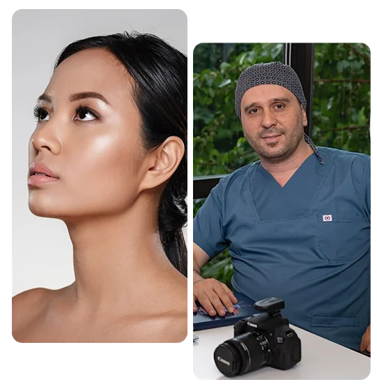 piezo-rhinoplasty-turkey