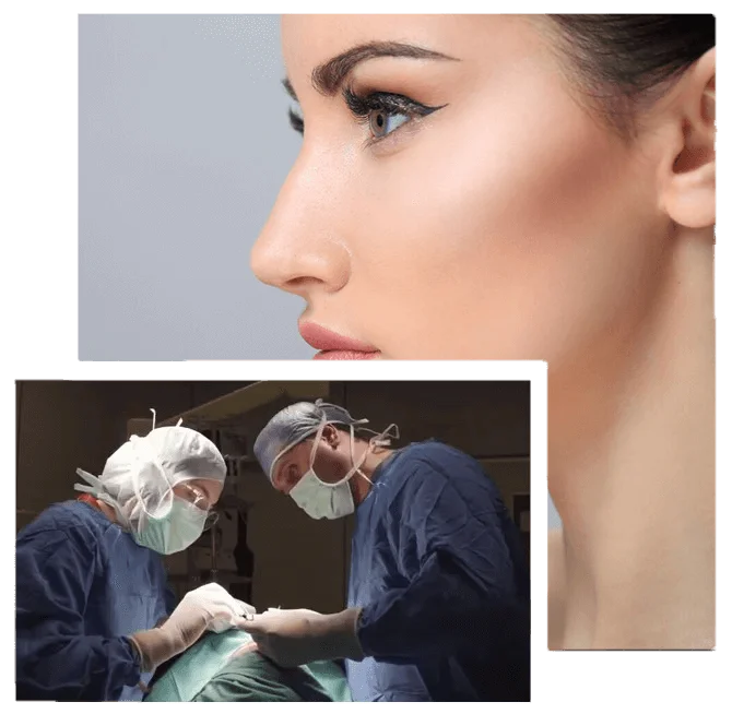 what-is-deviated-septum-rhinoplasty