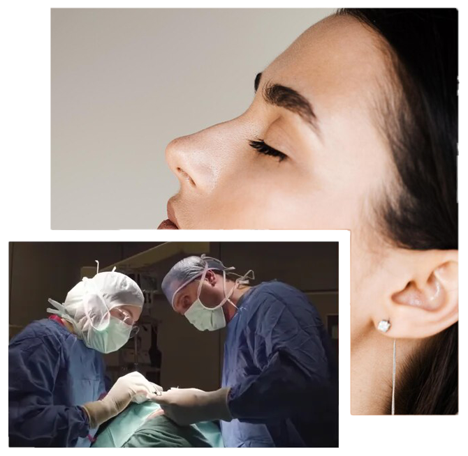 Ethnic Rhinoplasty in Turkey what-is-ethnic-rhinoplasty