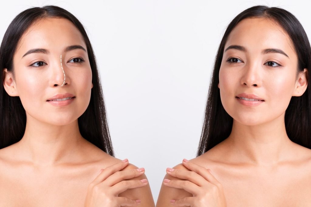 Blog signs-of-a-bad-rhinoplasty
