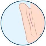 Kepçe Kulak Ameliyatı (Otoplasti) Kepçe Kulak Ameliyatı (Otoplasti)