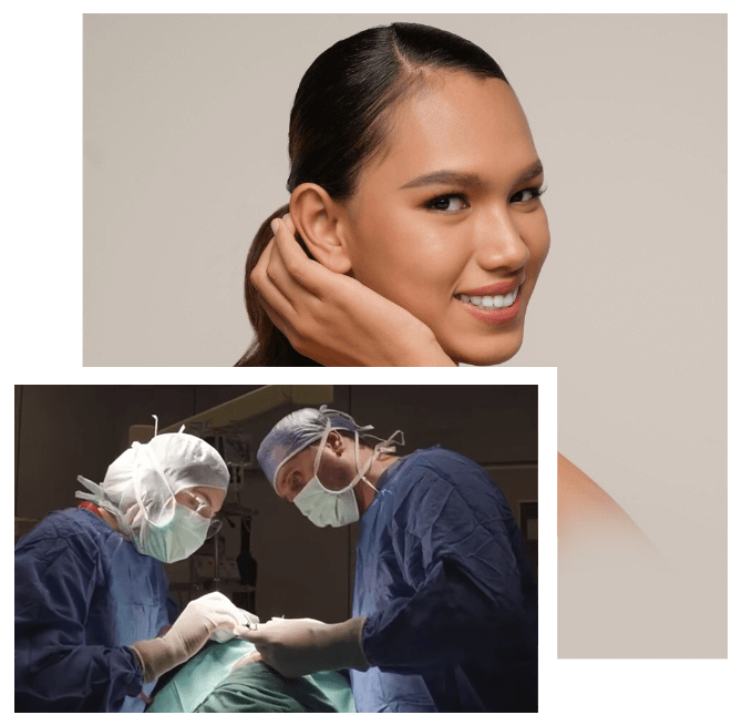 Otoplasty in Turkey Otoplasty in Turkey