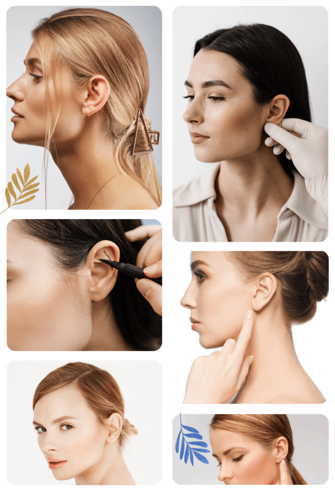 Otoplasty in Turkey Otoplasty in Turkey
