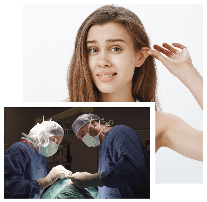 Otoplasty in Turkey Otoplasty in Turkey