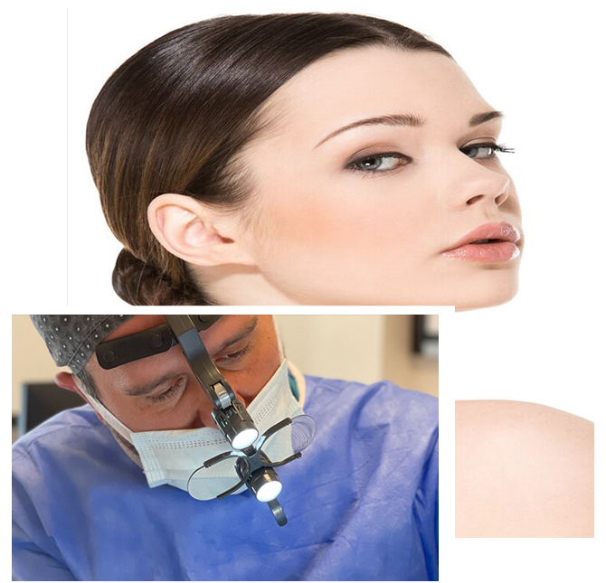 Revision Rhinoplasty in Turkey