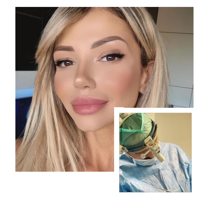 Closed Rhinoplasty in Turkey
