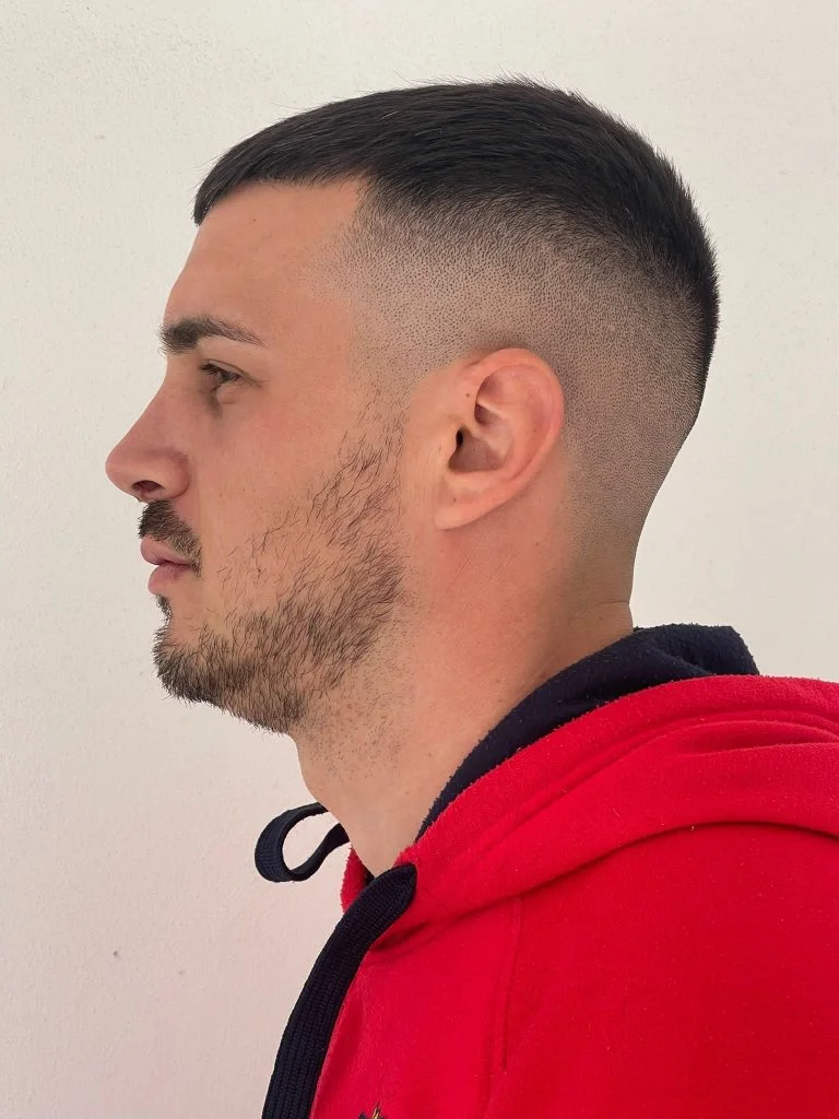 Septum Deviasyonu Ameliyatı Septum Deviasyonu Semptomları Nelerdir?