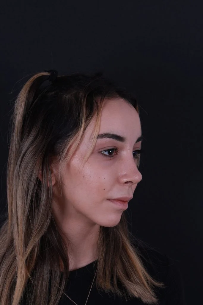 Burun Estetiği burun estetiği fiyatları