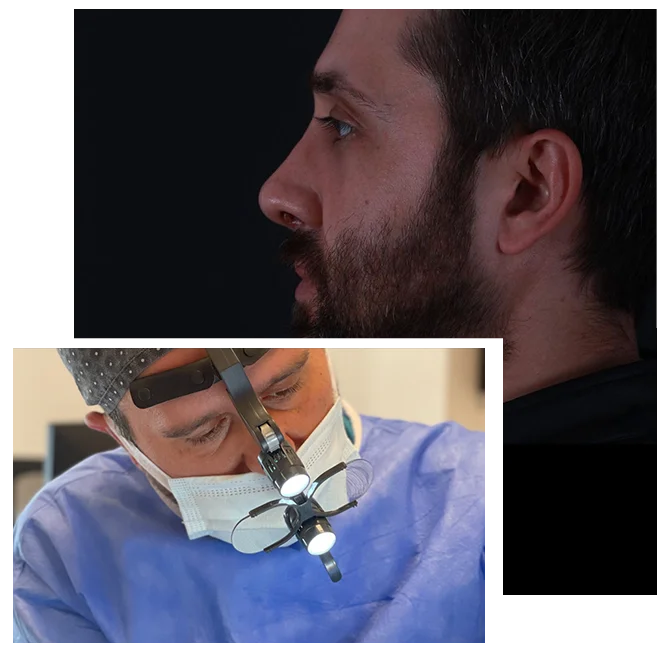 Erkek Burun Estetiği erkek rinoplasti