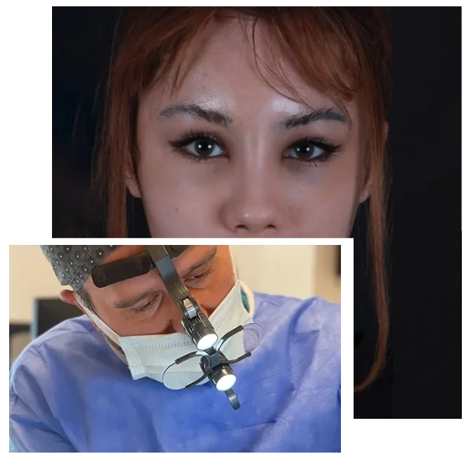 Tilki Göz Estetiği Tilki Göz Estetiği