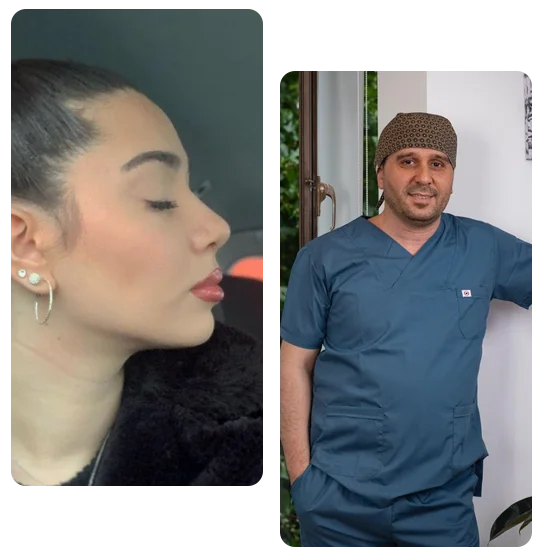 Nazal Polip Ameliyatı Nazal Polip Ameliyatı