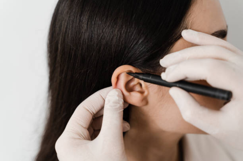 Kepçe Kulak Estetiği Sonrası Sık Sorulan Sorular