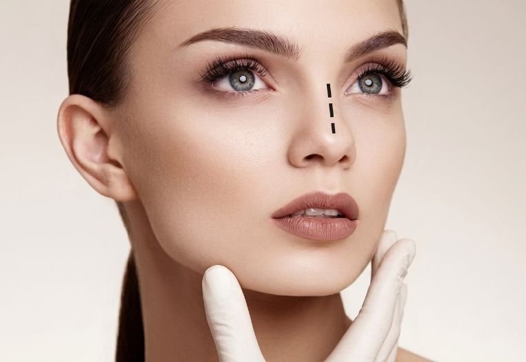Revision Rhinoplasty in Turkey