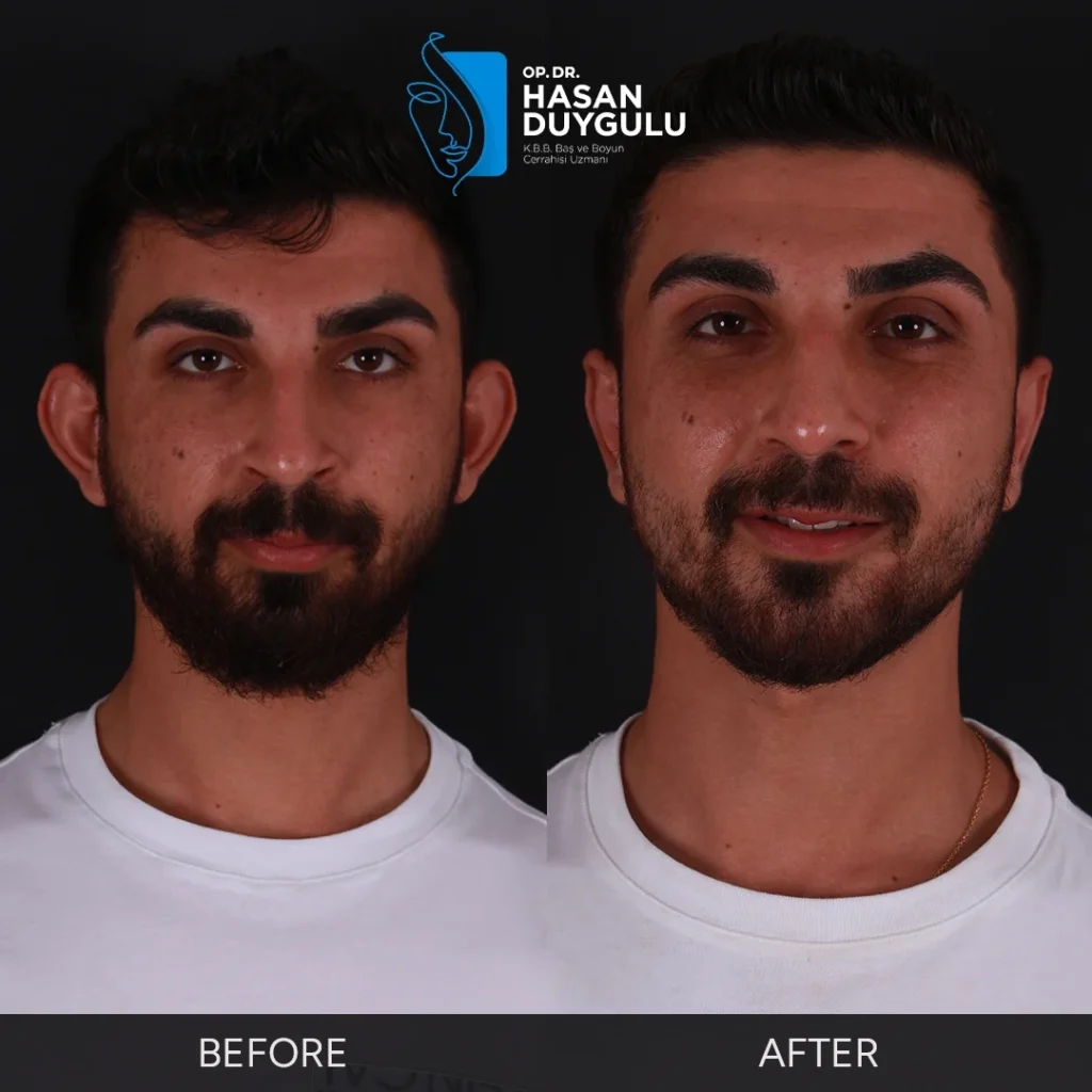 Before After Gallery